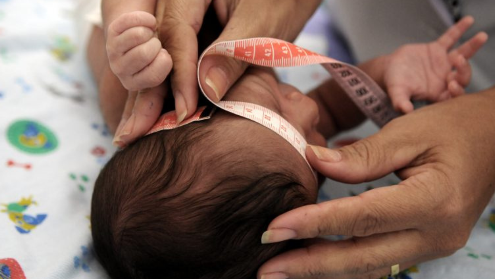 Pensão Especial Vitalícia garantida para pessoas com Síndrome Congênita do Zika Vírus